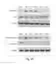 Fig. 06 - USE OF REMOTE ISCHEMIC CONDITIONING TO IMPROVE OUTCOME AFTER MYOCARDIAL INFARCTION