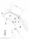 Fig. 04 - SCISSORS WITH BENT DISTAL PORTIONS