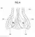 Fig. 05 - SCISSORS WITH BENT DISTAL PORTIONS