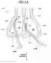 Fig. 06 - SCISSORS WITH BENT DISTAL PORTIONS