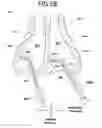 Fig. 07 - SCISSORS WITH BENT DISTAL PORTIONS