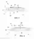 Fig. 04 - Dental floss