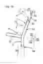 Fig. 03 - ASSISTIVE MOBILITY DEVICE