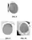 Fig. 08 - System and method for scale inhibition