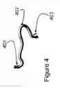 Fig. 05 - Inflatable leak diverter