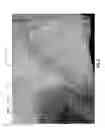 Fig. 11 - Woven multi-layer fabrics and methods of fabricating same