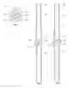 Fig. 04 - Segmented ball seat assembly valve