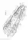 Fig. 04 - Milling tool for establishing openings in wellbore obstructions