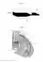 Fig. 05 - CRYSTALLINE POLYMER MICROPOROUS MEMBRANE, METHOD FOR PRODUCING THE SAME, AND FILTRATION FILTER USING THE SAME