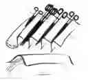 Fig. 02 - Apparatus configured to support surgical instruments