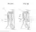 Fig. 07 - Sealing structure for aerosol container, aerosol container and aerosol container manufacturing method