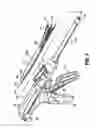 Fig. 04 - Surgical stapling apparatus with locking mechanism