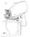 Fig. 02 - Fluid level indicator in an airless fluid sprayer