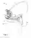 Fig. 02 - Fluid intake assembly for a fluid sprayer