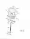 Fig. 10 - Fluid intake assembly for a fluid sprayer