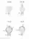 Fig. 03 - Electrostatic atomizer