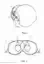 Fig. 03 - Vision equipment comprising an optical strip with a controlled coefficient of light transmission