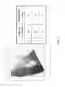 Fig. 03 - Multichip light emitting diode (LED) and method of manufacture