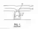 Fig. 02 - METAL GATE FILL BY OPTIMIZING ETCH IN SACRIFICIAL GATE PROFILE