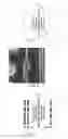 Fig. 02 - Dummy shoulder structure for line stress reduction