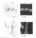 Fig. 05 - Dummy shoulder structure for line stress reduction