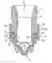 Fig. 01 - Connection piece