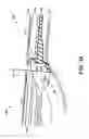 Fig. 06 - Vehicle window/garnish assembly and seal design therefor