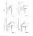 Fig. 04 - Crash-active headrest having a locking pushbutton