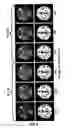 Fig. 09 - O-space imaging: highly efficient parallel imaging using complementary nonlinear encoding gradient fields and receive coil geometries