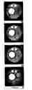 Fig. 10 - O-space imaging: highly efficient parallel imaging using complementary nonlinear encoding gradient fields and receive coil geometries