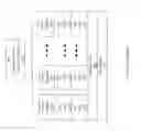 Fig. 02 - On-coil current mode class D RF power amplifier in high field parallel transmission MRI