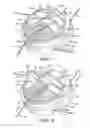 Fig. 05 - Cable wrap security device
