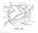 Fig. 10 - Cable wrap security device
