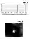 Fig. 05 - Virtual endoscopic image generated using an opacity curve