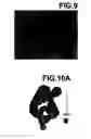 Fig. 07 - Virtual endoscopic image generated using an opacity curve