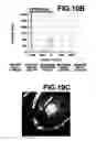 Fig. 08 - Virtual endoscopic image generated using an opacity curve
