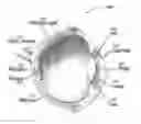 Fig. 01 - System and method for automated detection of age related macular degeneration and other retinal abnormalities
