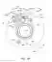 Fig. 17 - Lens barrel and imaging device