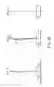 Fig. 16 - Zoom lens