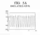 Fig. 07 - High voltage power supply