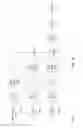 Fig. 09 - Frequency-dependent ANR reference sound compression