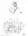 Fig. 03 - Modular hearing device