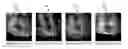 Fig. 01 - Method and system for multiple object detection by sequential Monte Carlo and hierarchical detection network