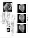 Fig. 12 - Method and system for multiple object detection by sequential Monte Carlo and hierarchical detection network