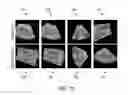 Fig. 13 - Method and system for multiple object detection by sequential Monte Carlo and hierarchical detection network