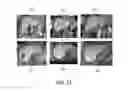 Fig. 15 - Method and system for multiple object detection by sequential Monte Carlo and hierarchical detection network