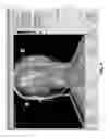 Fig. 04 - Medical imaging system and related methods