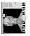 Fig. 06 - Medical imaging system and related methods