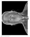Fig. 07 - Medical imaging system and related methods