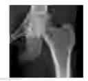 Fig. 01 - Morphometry of the human hip joint and prediction of osteoarthritis